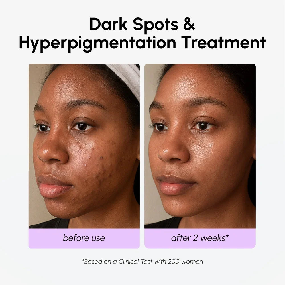 Dark Spot Corrector